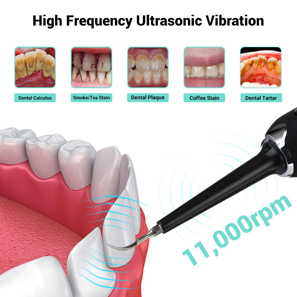 Portable Ultrasonic Tooth Cleaner for Home Use